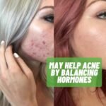 Estrohalt Hormone Balance Supplement - Image 3