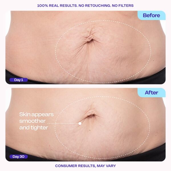 goPure Belly Cream - Image 3