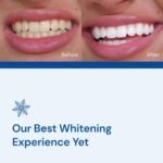 Snow Teeth Whitening Kit - Image 2