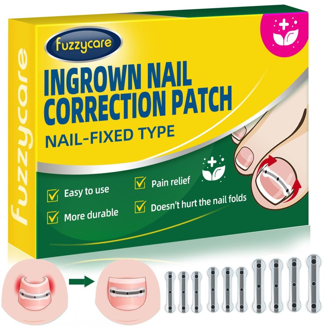 Version 1.0.0 Titanium Ingrown Toenail Kit - Image 1