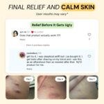 Skin Relief Solution - Image 4