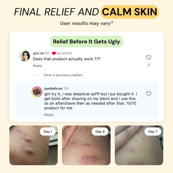 Skin Relief Solution - Image 4