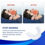 AUOUA Life Snoring Mouthpiece - Image 3