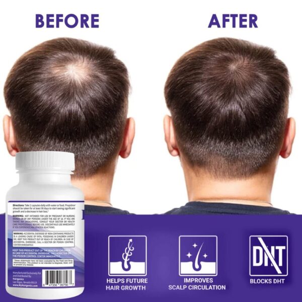 Propidren DHT Blocker Capsules - Image 7