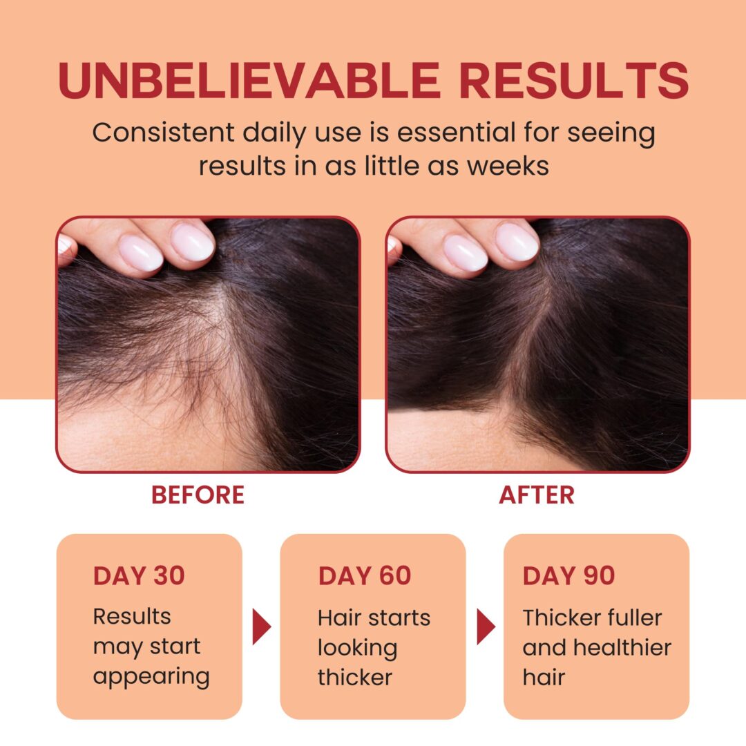Version 1.0.0 Organic Batana Hair Oil - Image 3