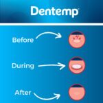 Dentemp Canker Cover Tablets - Image 7