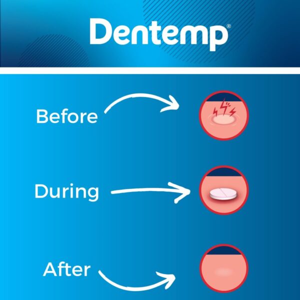 Dentemp Canker Cover Tablets - Image 7