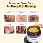 Skin Relief Solution - Image 2