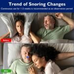 Mini Anti Snoring Device - Image 3